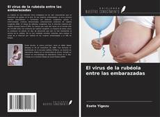 Buchcover von El virus de la rubéola entre las embarazadas