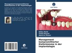 Copertina di Management kompromittierter Kieferkämme in der Implantologie