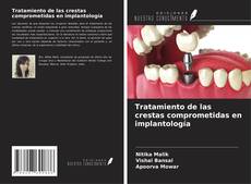 Buchcover von Tratamiento de las crestas comprometidas en implantología
