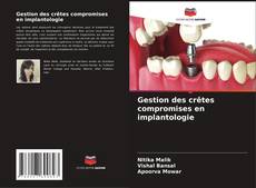 Bookcover of Gestion des crêtes compromises en implantologie