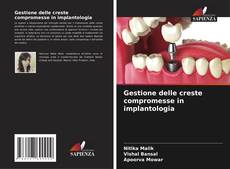 Bookcover of Gestione delle creste compromesse in implantologia