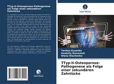 Couverture de ТTyp-II-Osteoporose-Pathogenese als Folge einer sekundären Zahnlücke