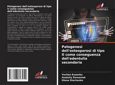 Capa do livro de Patogenesi dell'osteoporosi di tipo II come conseguenza dell'edentulia secondaria 