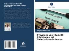 Copertina di Prävalenz von HIV/AIDS-Infektionen bei Tuberkulose-Patienten