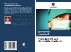 Bookcover of Management von Unterkieferfrakturen