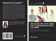 Buchcover von Asociación del acné vulgar con la testosterona sérica y la SHBG