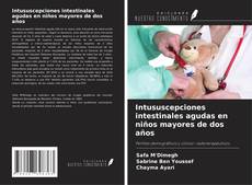Buchcover von Intususcepciones intestinales agudas en niños mayores de dos años