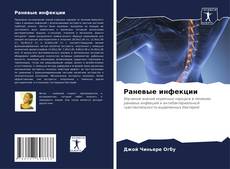Bookcover of Раневые инфекции