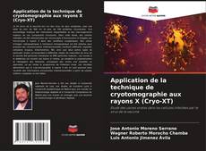 Copertina di Application de la technique de cryotomographie aux rayons X (Cryo-XT)