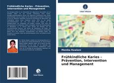 Portada del libro de Frühkindliche Karies - Prävention, Intervention und Management