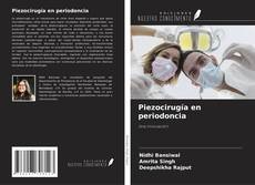 Buchcover von Piezocirugía en periodoncia