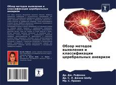 Buchcover von Обзор методов выявления и классификации церебральных аневризм
