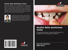 Bookcover of Analisi della dentizione mista