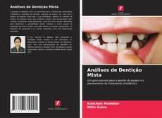 Análises de Dentição Mista kitap kapağı