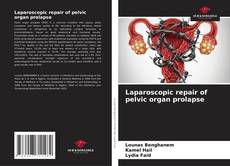 Bookcover of Laparoscopic repair of pelvic organ prolapse