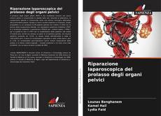 Buchcover von Riparazione laparoscopica del prolasso degli organi pelvici