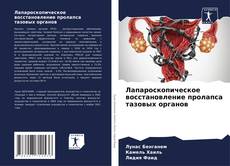 Portada del libro de Лапароскопическое восстановление пролапса тазовых органов