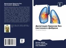 Bookcover of Дилатация бронхов без кистозного фиброза