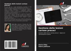Bookcover of Gestione delle lesioni cariose precoci