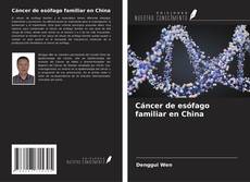 Copertina di Cáncer de esófago familiar en China