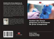 Copertina di Gestion des tissus gingivaux et techniques de prise d'empreinte