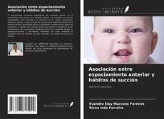 Buchcover von Asociación entre espaciamiento anterior y hábitos de succión