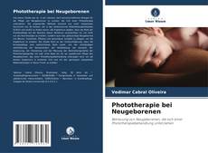 Borítókép a  Phototherapie bei Neugeborenen - hoz