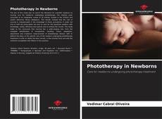 Phototherapy in Newborns的封面