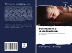 Capa do livro de Фототерапия у новорожденных 