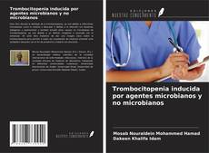 Bookcover of Trombocitopenia inducida por agentes microbianos y no microbianos
