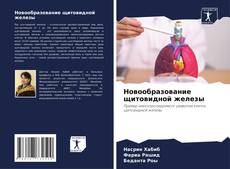 Bookcover of Новообразование щитовидной железы