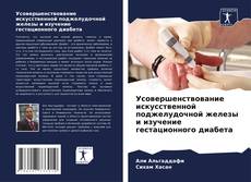 Bookcover of Усовершенствование искусственной поджелудочной железы и изучение гестационного диабета