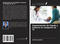 Buchcover von Segmentación de hígado y tumores en imágenes de TC