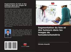 Bookcover of Segmentation du foie et des tumeurs dans les images de tomodensitométrie