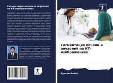 Buchcover von Сегментация печени и опухолей на КТ-изображениях