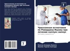 Buchcover von Чрескожная остеотомия по Ревердину-Ишаму при лечении халлукс валнус