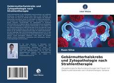 Обложка Gebärmutterhalskrebs und Zytopathologie nach Strahlentherapie