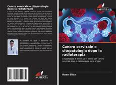 Borítókép a  Cancro cervicale e citopatologia dopo la radioterapia - hoz