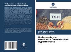 Bookcover of Umfassende und detaillierte Übersicht über Hyperthyreose