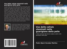 Uso delle cellule staminali nella guarigione della pelle kitap kapağı