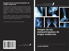 Buchcover von Imagen de las osteoartropatías de origen endocrino