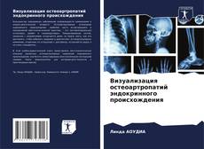 Buchcover von Визуализация остеоартропатий эндокринного происхождения