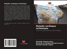 Maladie cardiaque ischémique kitap kapağı