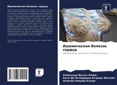 Buchcover von Ишемическая болезнь сердца