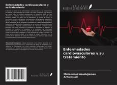 Buchcover von Enfermedades cardiovasculares y su tratamiento