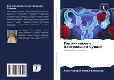 Buchcover von Рак яичников в Центральном Судане