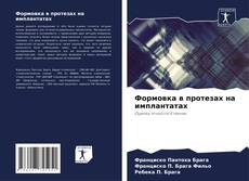 Buchcover von Формовка в протезах на имплантатах