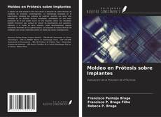 Couverture de Moldeo en Prótesis sobre Implantes