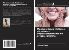 Couverture de Mantenimiento higiénico de prótesis implantosoportadas de arcada completa