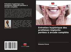 Entretien hygiénique des prothèses implanto-portées à arcade complète kitap kapağı